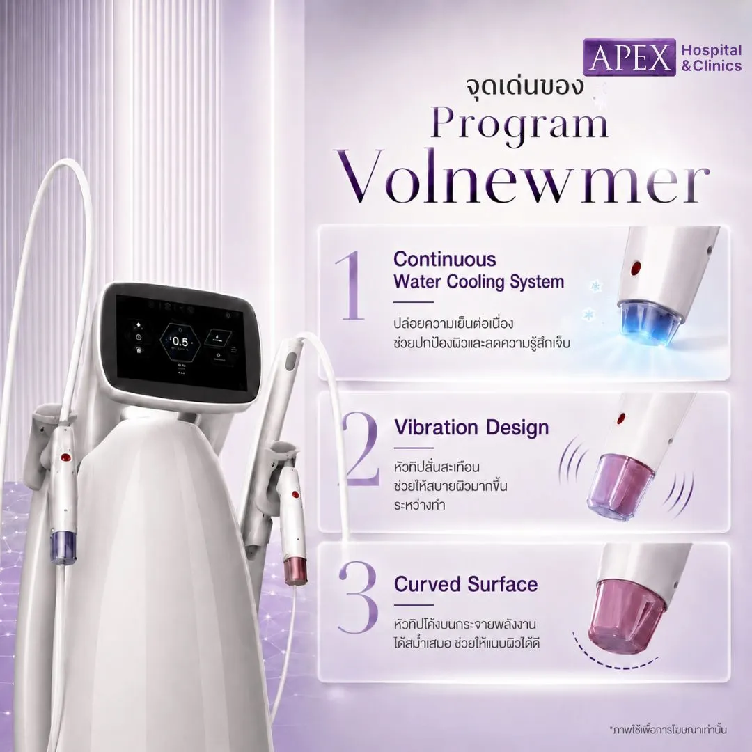 จุดเด่น Volnewmer