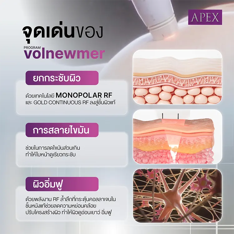 จุดเด่นของ Volnewmer