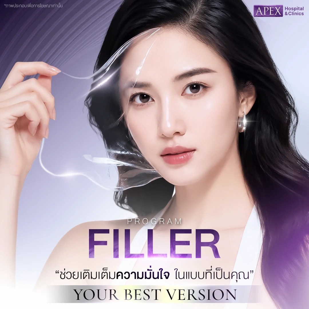 ฉีดฟิลเลอร์ (Filler)