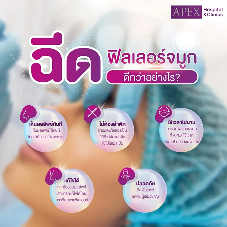 ข้อดีฉีดฟิลเลอร์จมูก