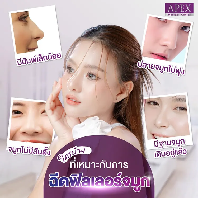 ฉีดฟิลเลอร์จมูก เหมาะกับใคร