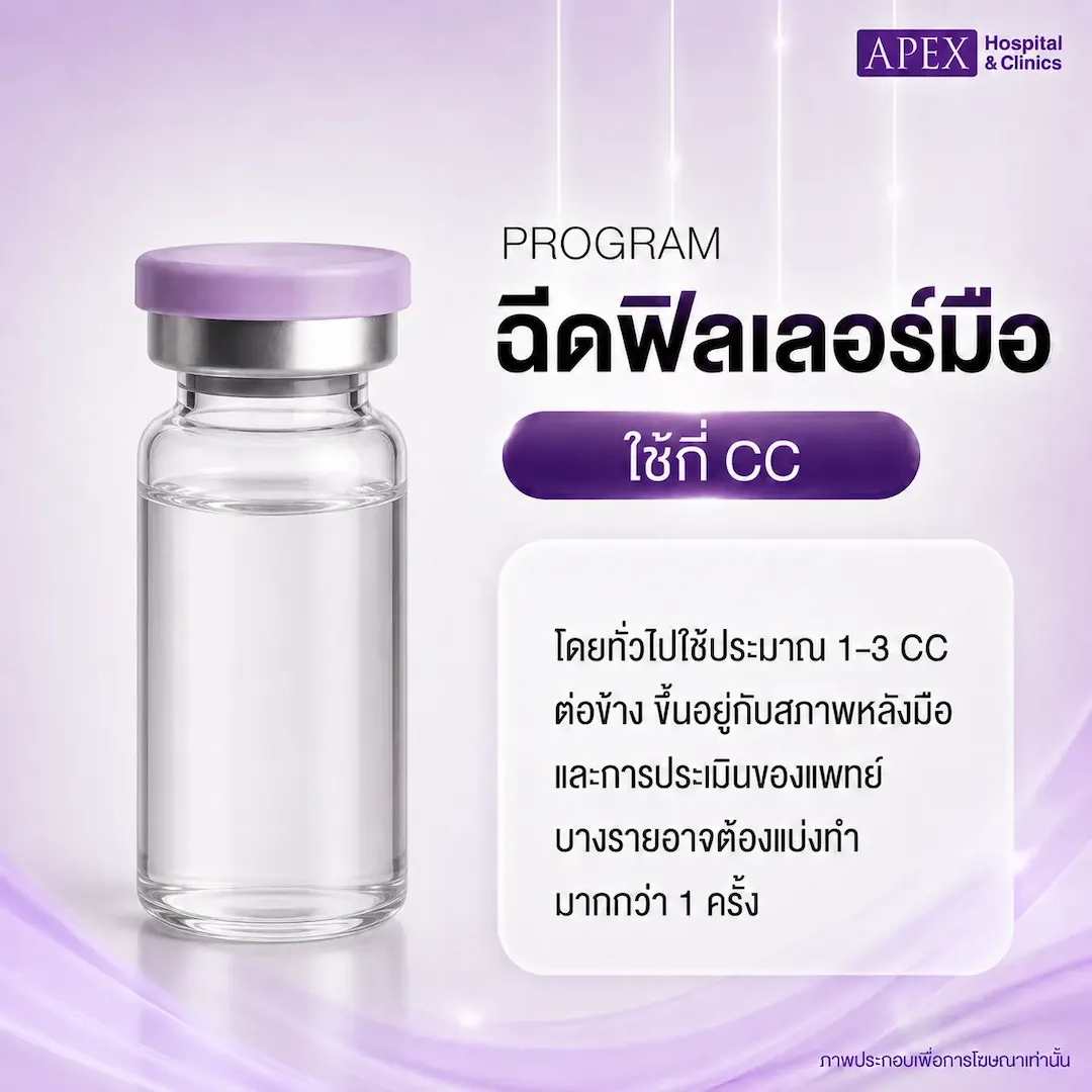 ฉีดฟิลเลอร์มือใช้กี่ CC