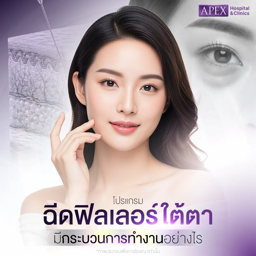 ฉีดฟิลเลอร์ใต้ตา