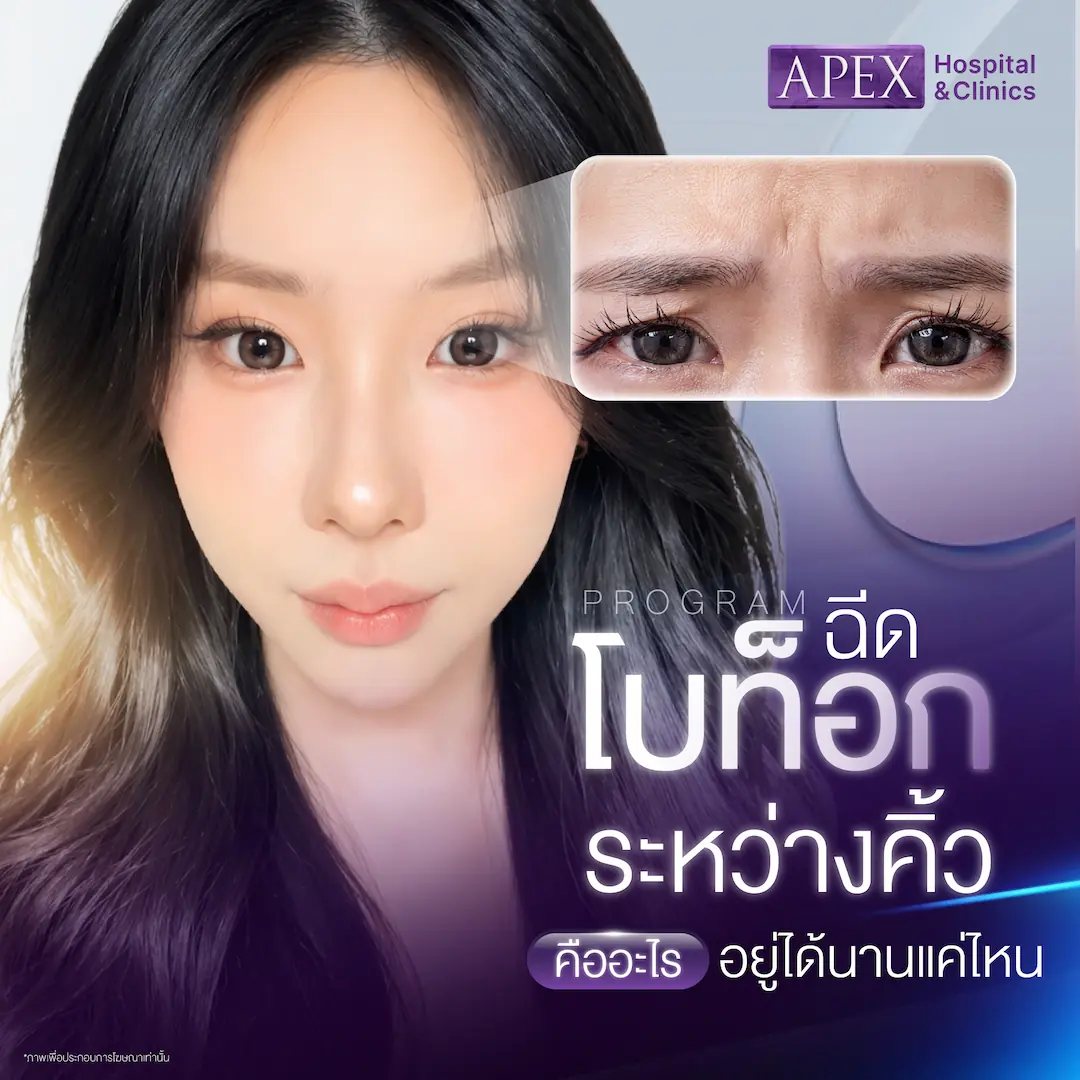 ฉีดโบท็อกระหว่างคิ้ว