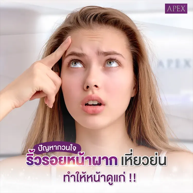 ฉีดโบท็อกหน้าผาก