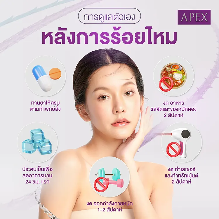 ดูแลหลัง ร้อยไหม