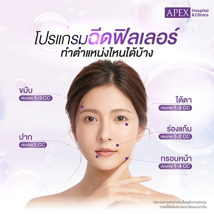 ตำแหน่งฉีดฟิลเลอร์