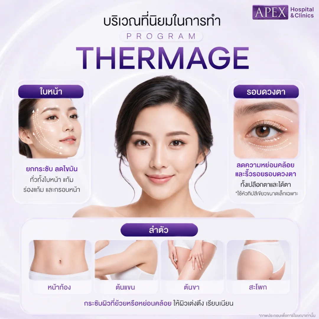 บริเวณที่นิยมในการทำ Thermage
