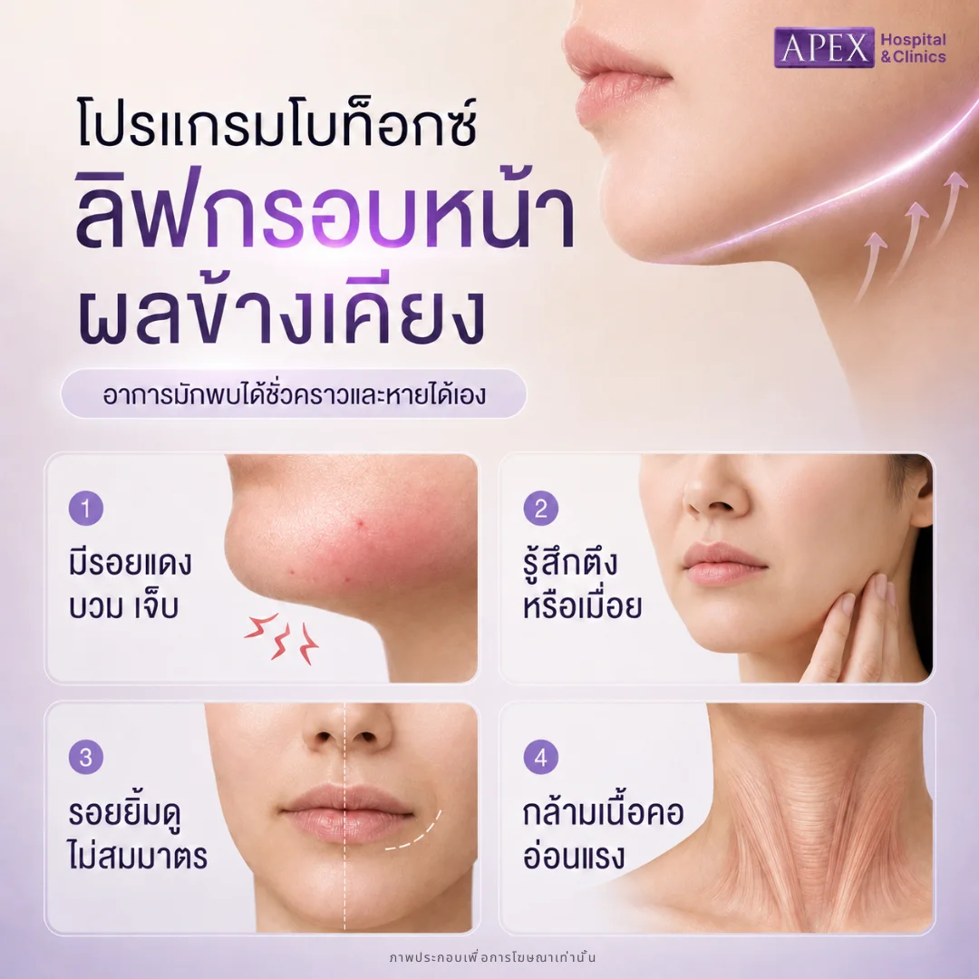 ผลข้างเคียงหลังฉีดโบท็อกลิฟกรอบหน้า