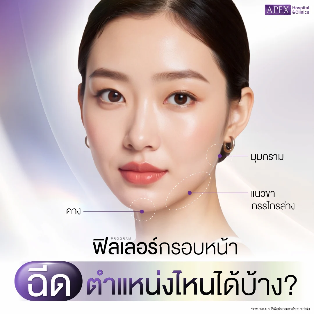 ฟิลเลอร์กรอบหน้า ฉีดตำแหน่งไหน