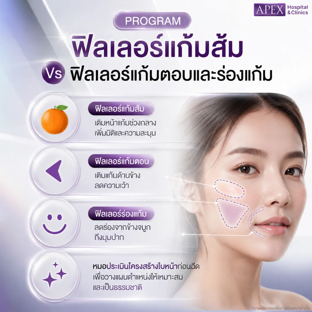 ฟิลเลอร์แก้มส้ม Vs ฟิลเลอร์แก้มตอบและร่องแก้ม