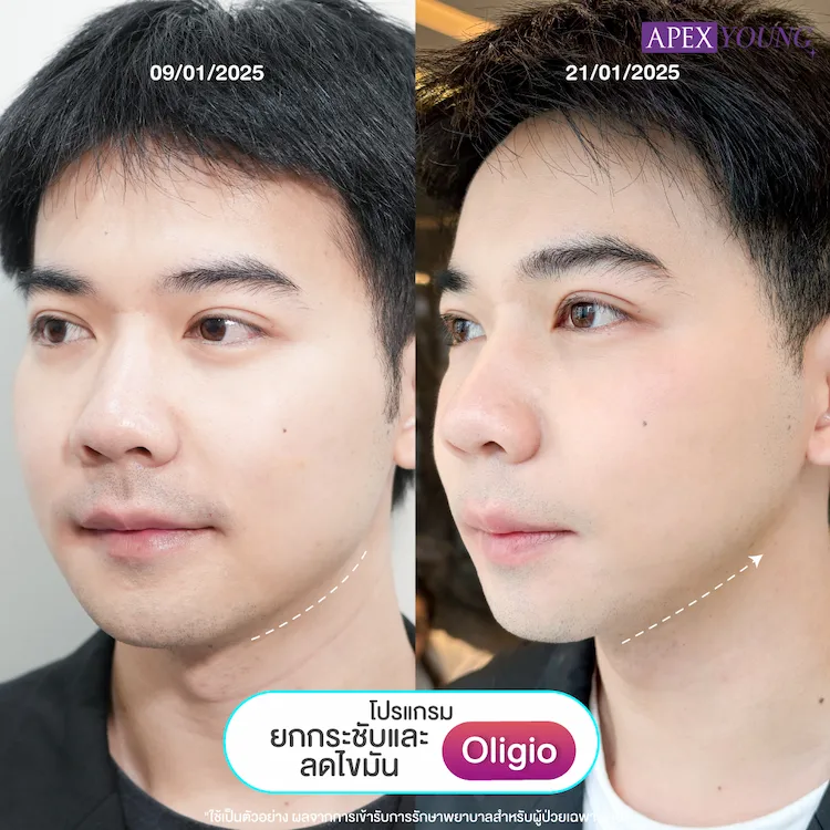 รีวิว Oligio