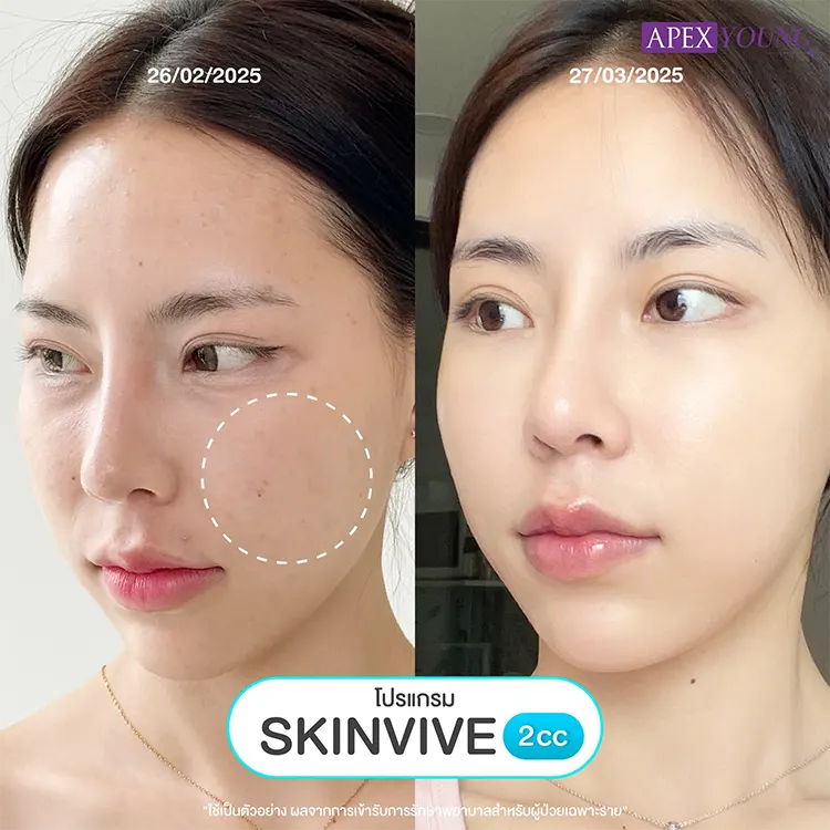 รีวิว Skinvive
