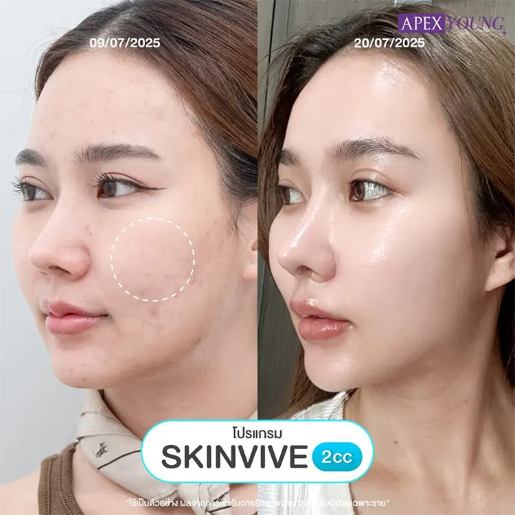 รีวิว Skinvive