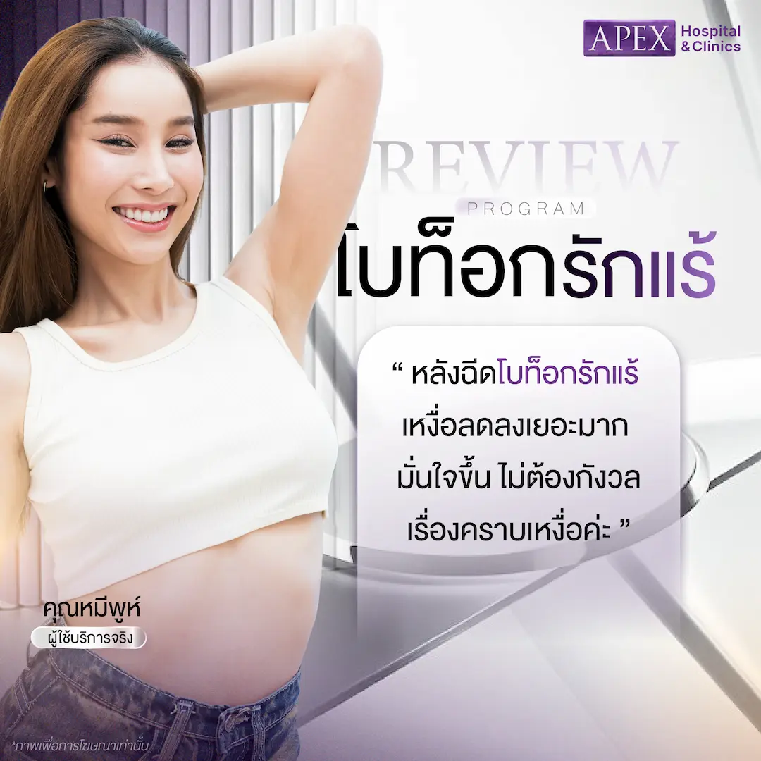 รีวิวหลังฉีดโบท็อกรักแร้