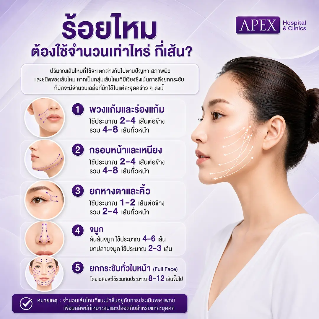 ร้อยไหมกี่เส้น ต้องใช้เยอะไหม