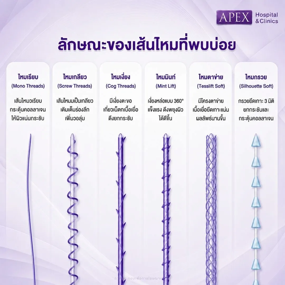 ลักษณะของเส้นไหมที่พบบ่อย