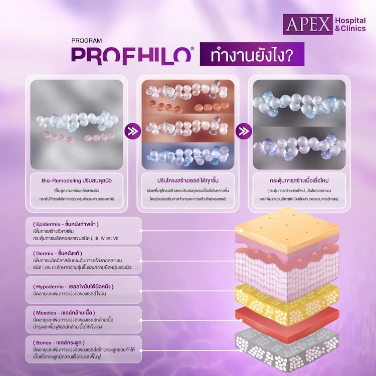 หลักการทำงาน Profhilo