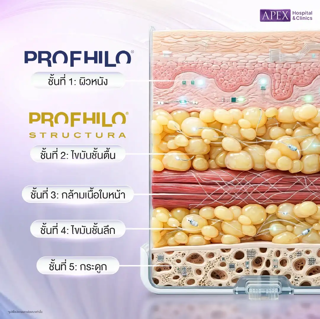 หลักการทำงานของ Profhilo อย่างไร
