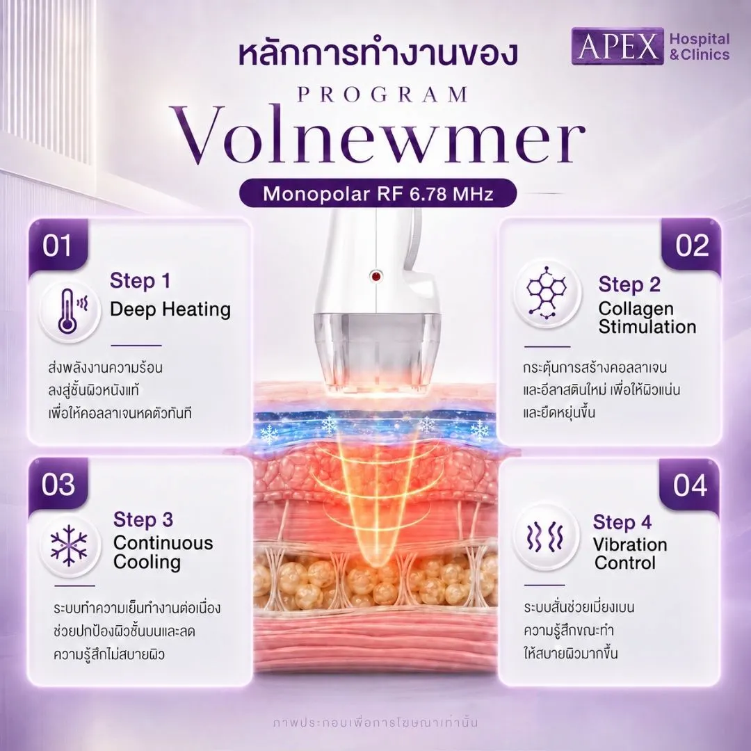 หลักการทำงานของ Volnewmer