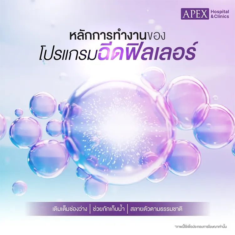 หลักการทำงานของฟิลเลอร์