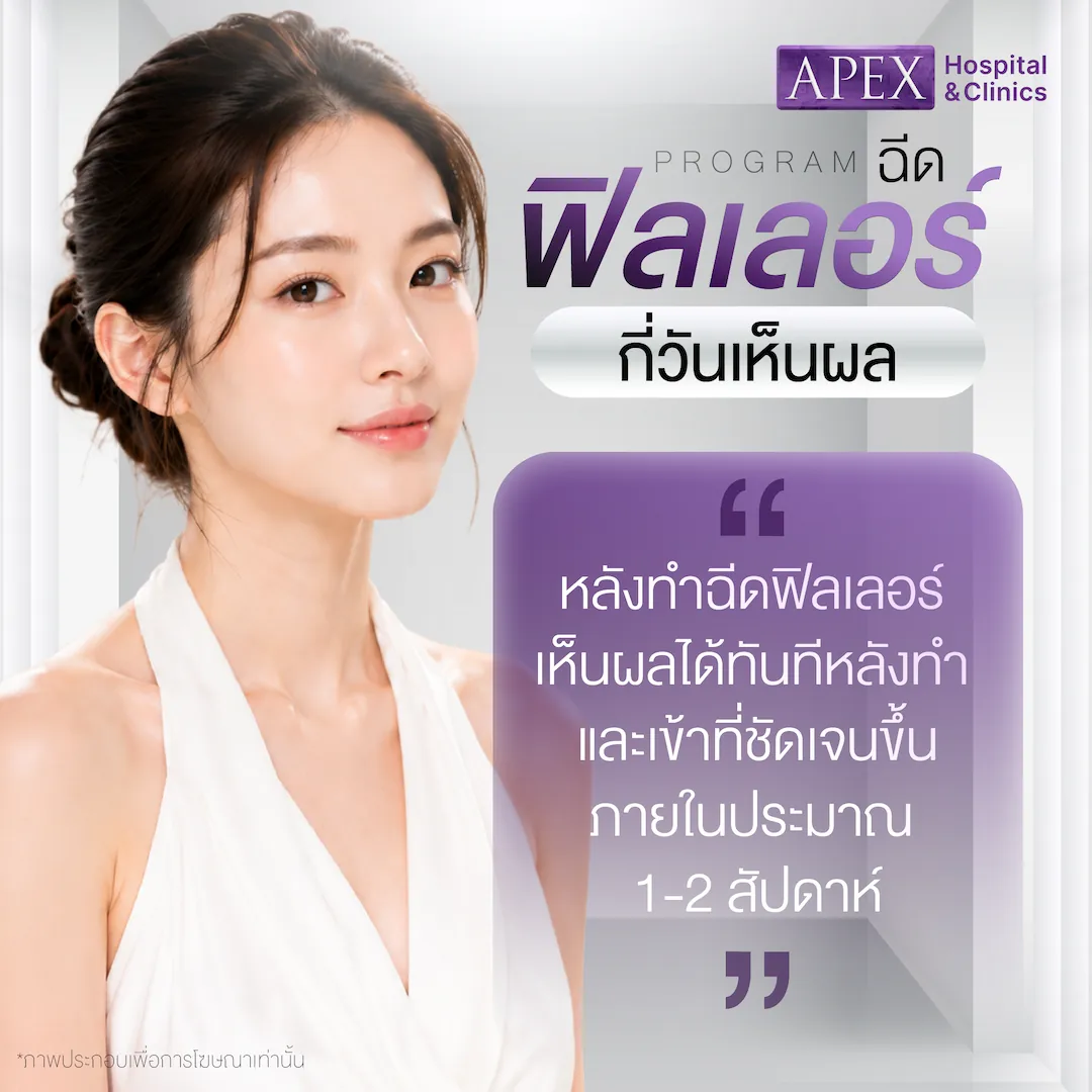 หลังฉีดฟิลเลอร์กี่วันถึงเข้าที่