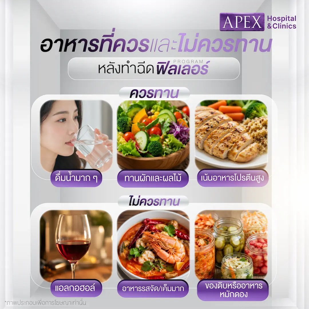 หลังฉีดฟิลเลอร์ควรและไม่ควรทานอะไร