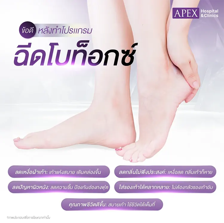 หลังฉีดโบท็อกซ์ฝ่าเท้า