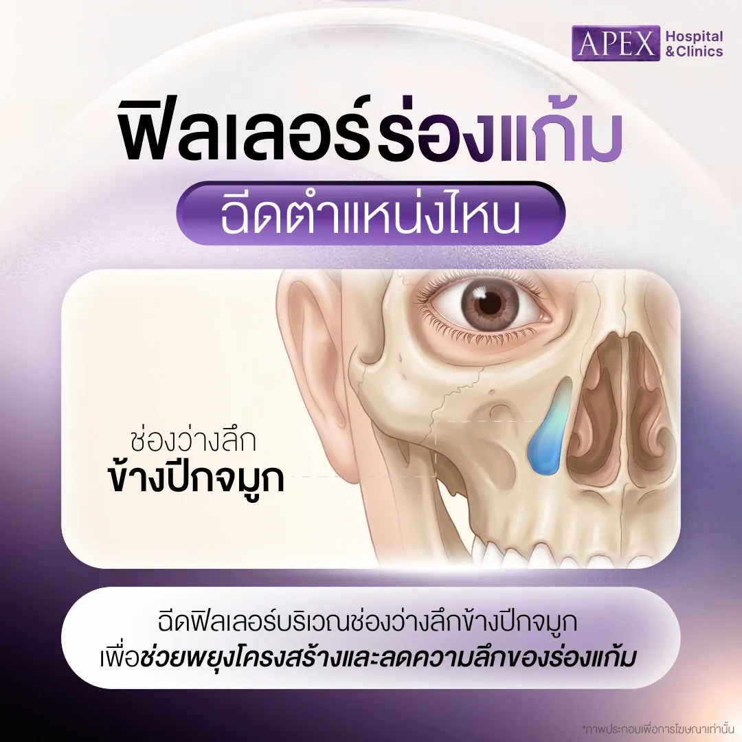 เช็กร่องแก้มแบบไหน ควรแก้ตรงจุดใด