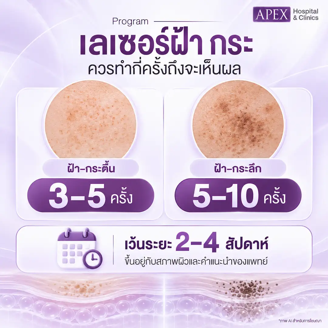 เลเซอร์ฝ้า กระ ควรทำกี่ครั้งถึงจะเห็นผล