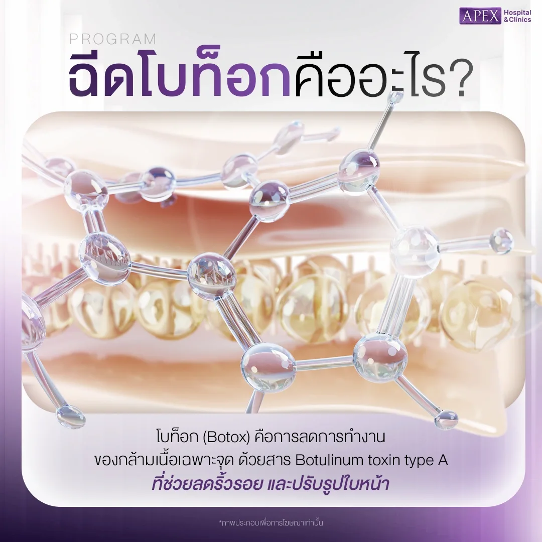 โบท็อก คืออะไร