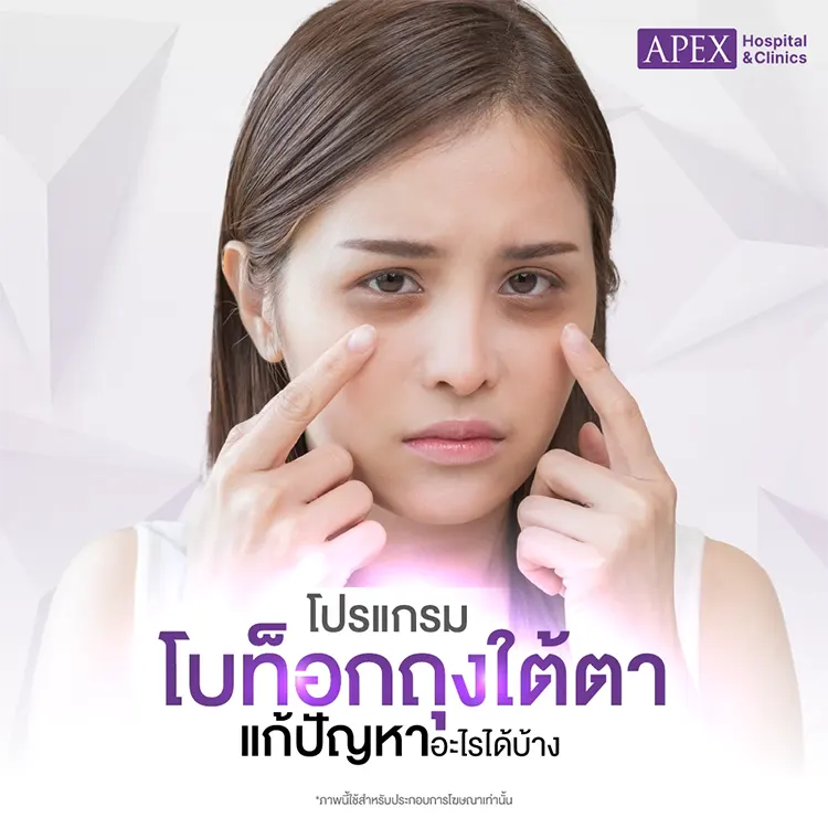 ข้อดี โบท็อกถุงใต้ตา