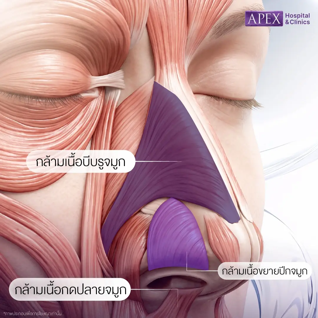 โบท็อกปีกจมูก คืออะไร