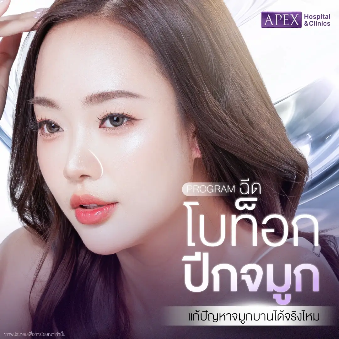 โบท็อกปีกจมูก