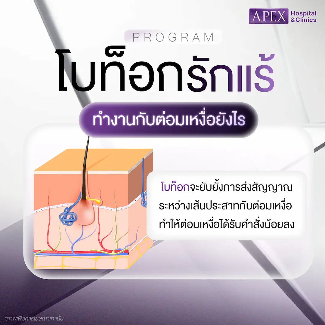 โบท็อกรักแร้ ทำงานกับต่อมเหงื่ออย่างไร