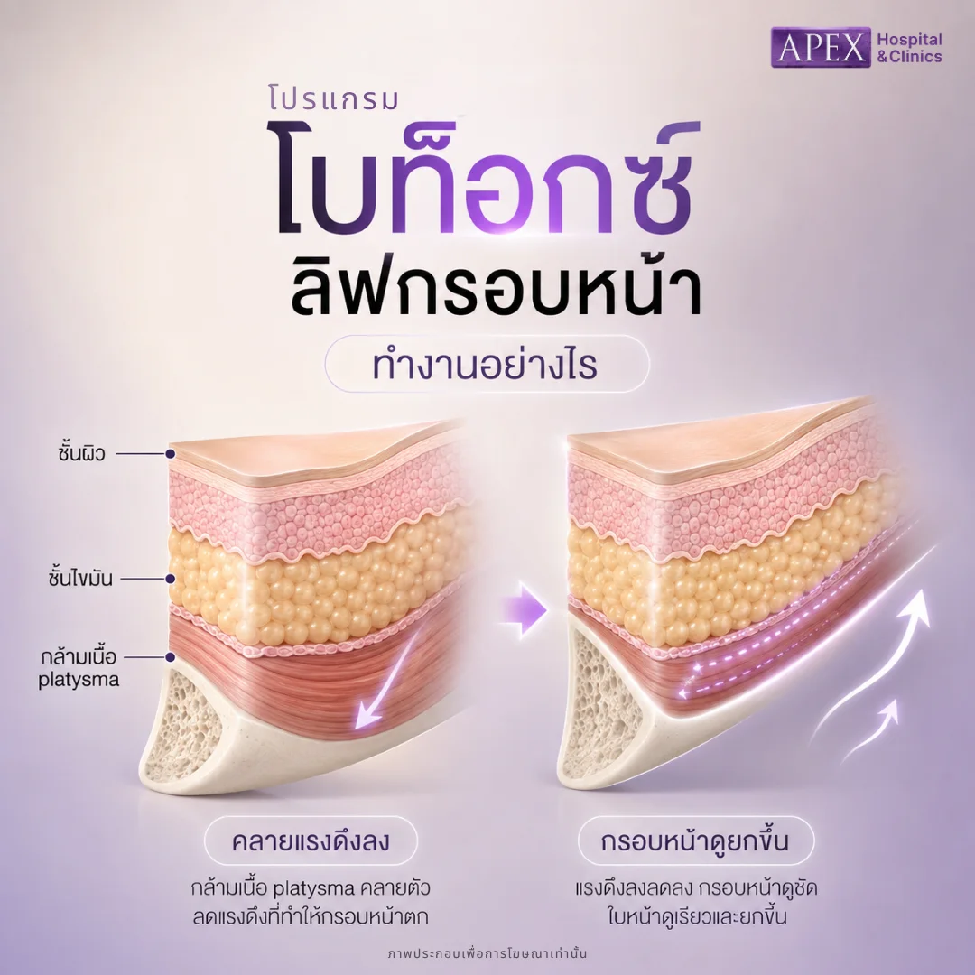 โบท็อกลิฟกรอบหน้า ทำงานอย่างไร