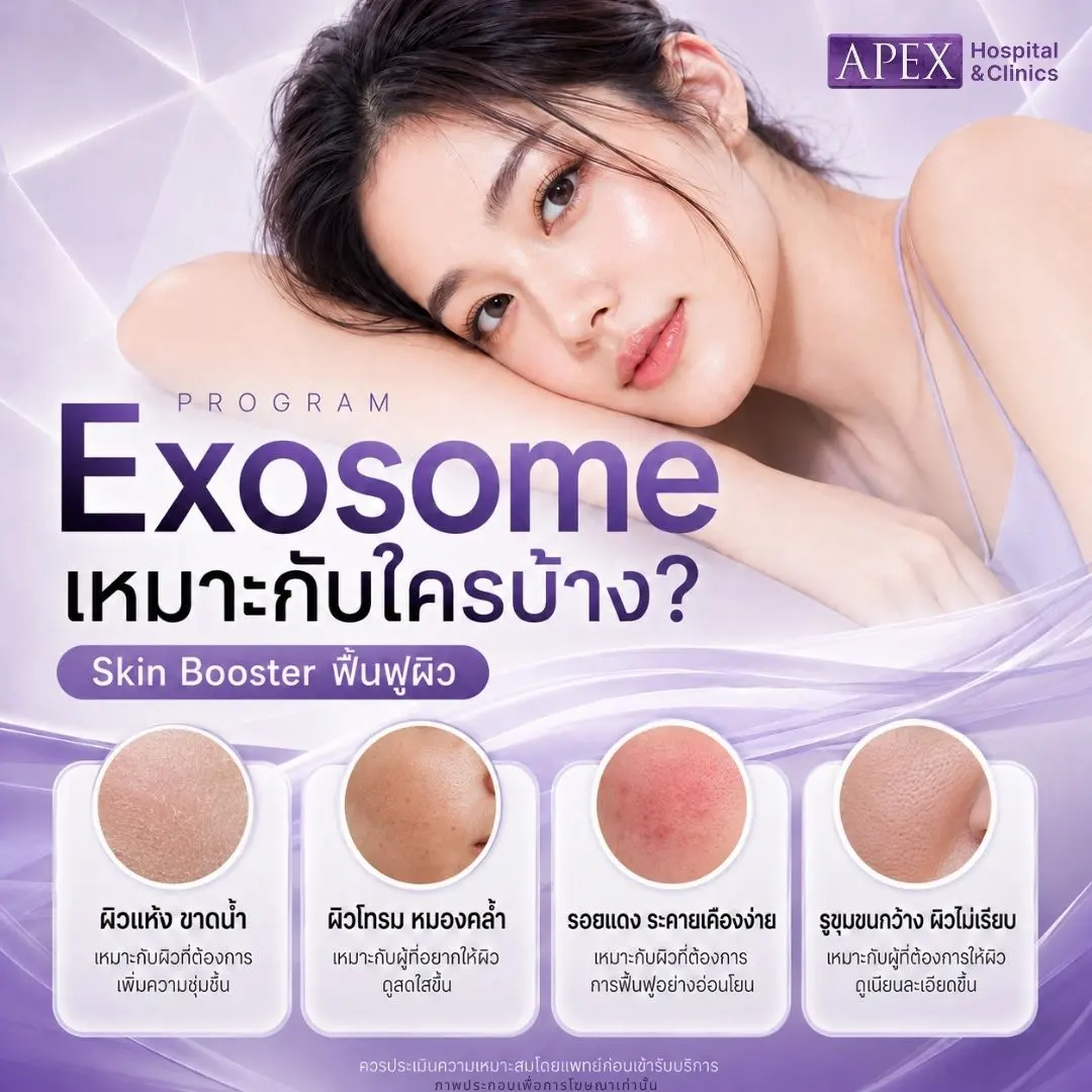 ใครบ้างที่เหมาะกับการทำ Exosome