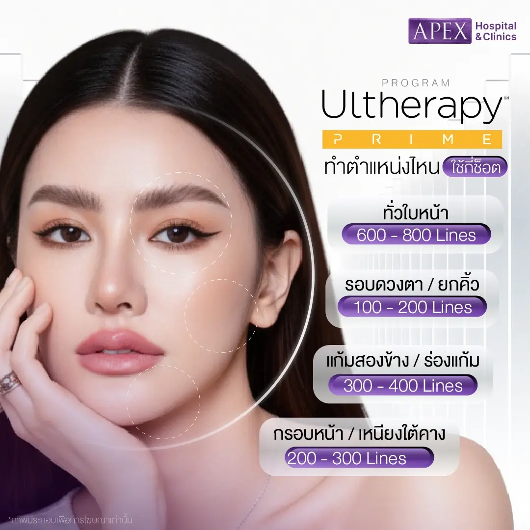 ต้องใช้ Ultherapy Prime กี่ไลน์ในแต่ละจุด