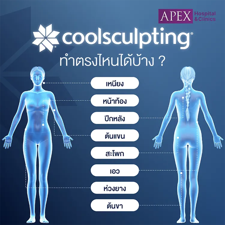 Coolsculpting ทำจุดไหนได้บ้าง