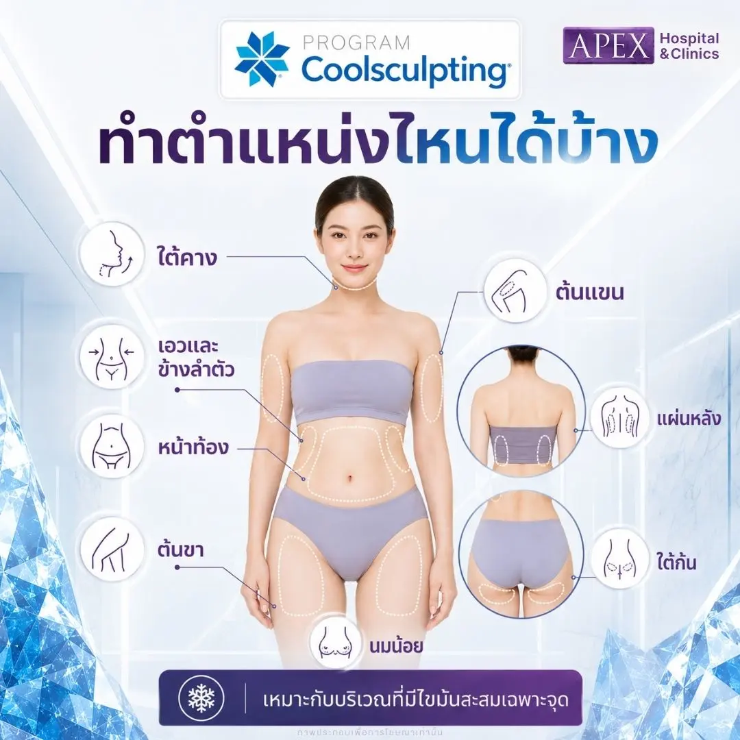 Coolsculpting ทำตำแหน่งไหนได้บ้าง