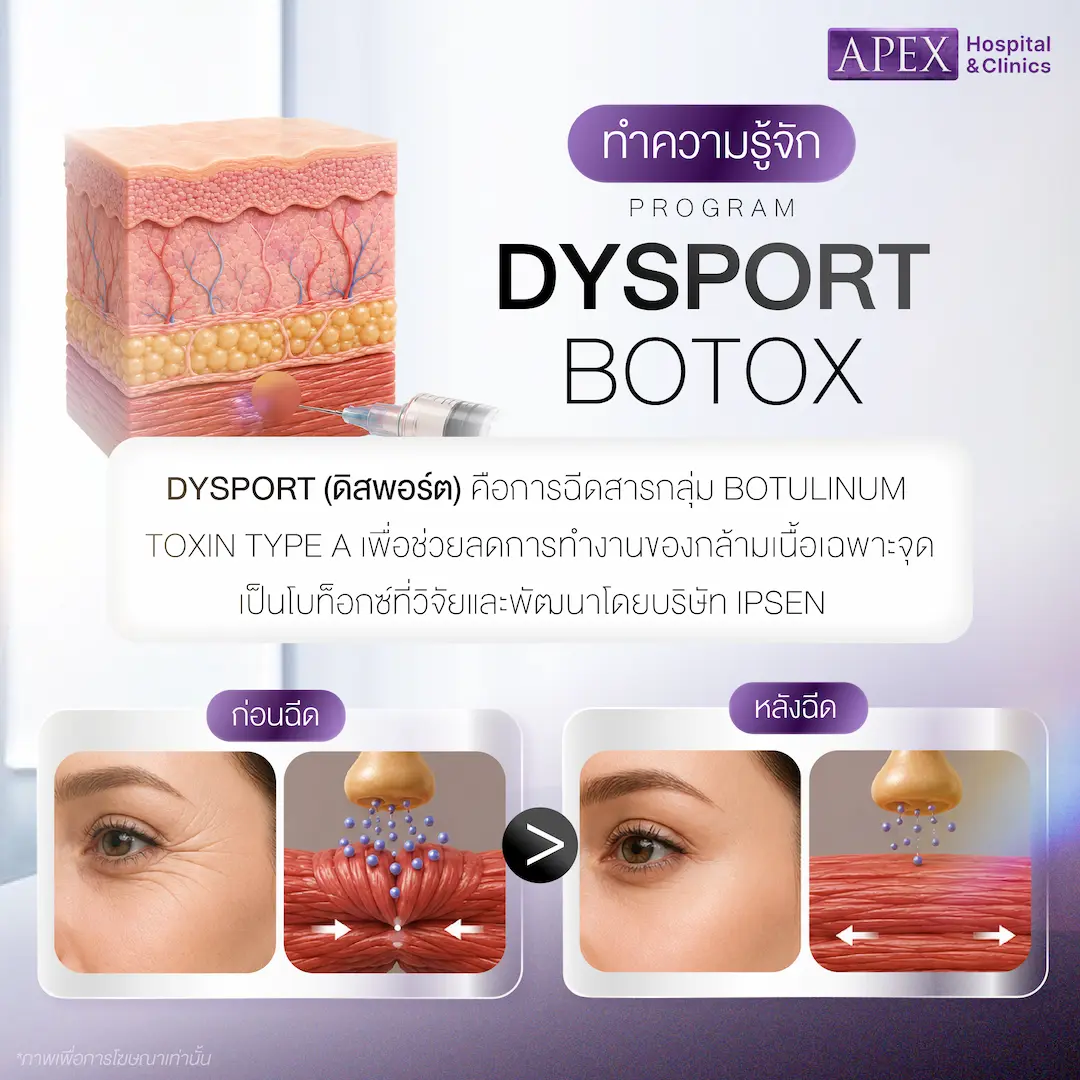 Dysport Botox คืออะไร