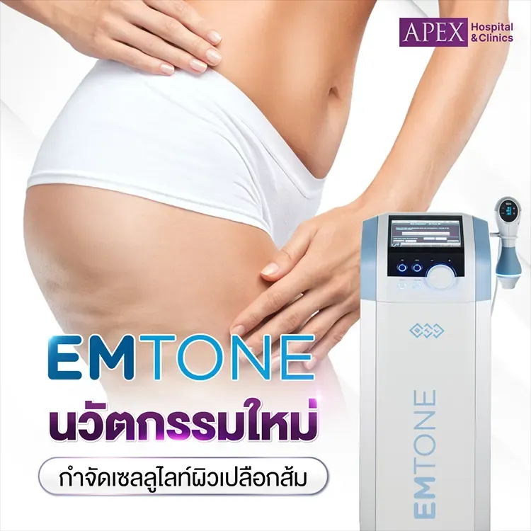 Emtone