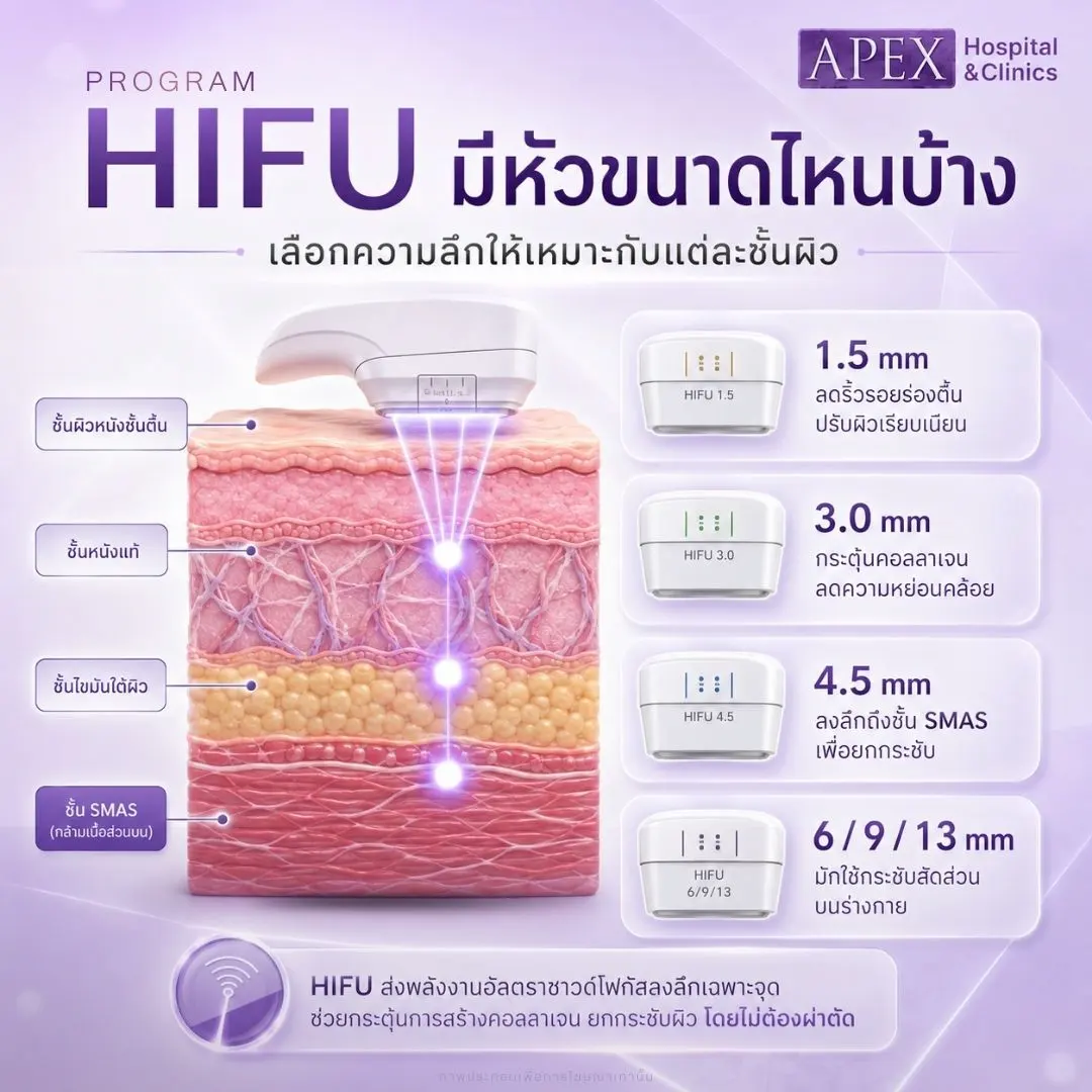 HIFU มีหัวขนาดไหนบ้าง