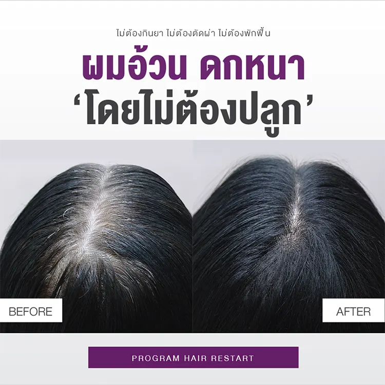 Hair Restart รีวิว