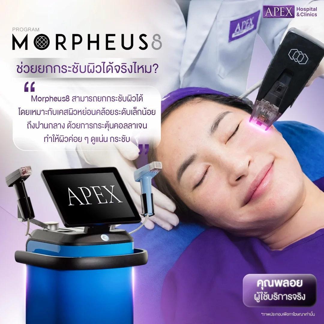 Morpheus8 ช่วยยกกระชับผิวได้จริงไหม