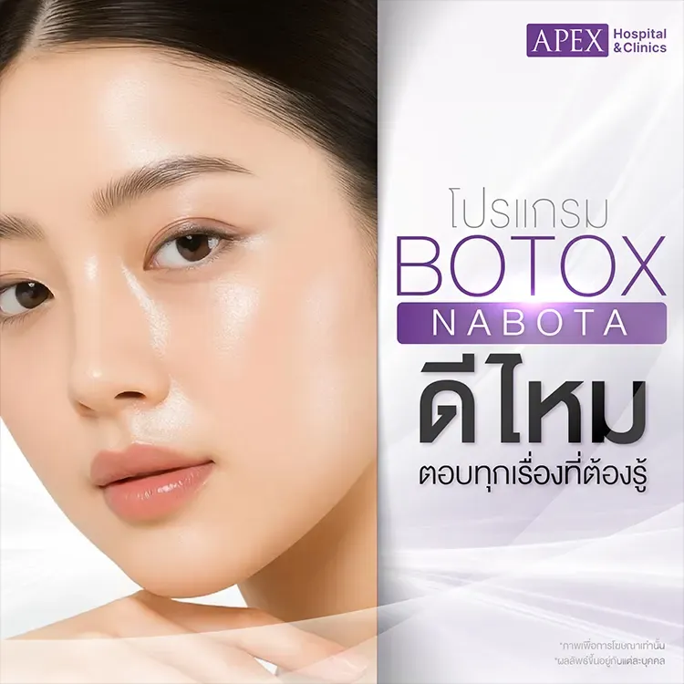 Nabota Botox