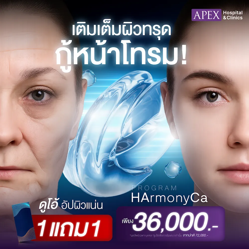 HarmonyCa 1 แถม 1 ราคาเพียง 36,000 บาท