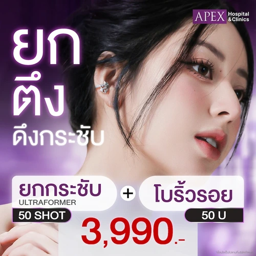 Ultraformer 50 Shot + Botox