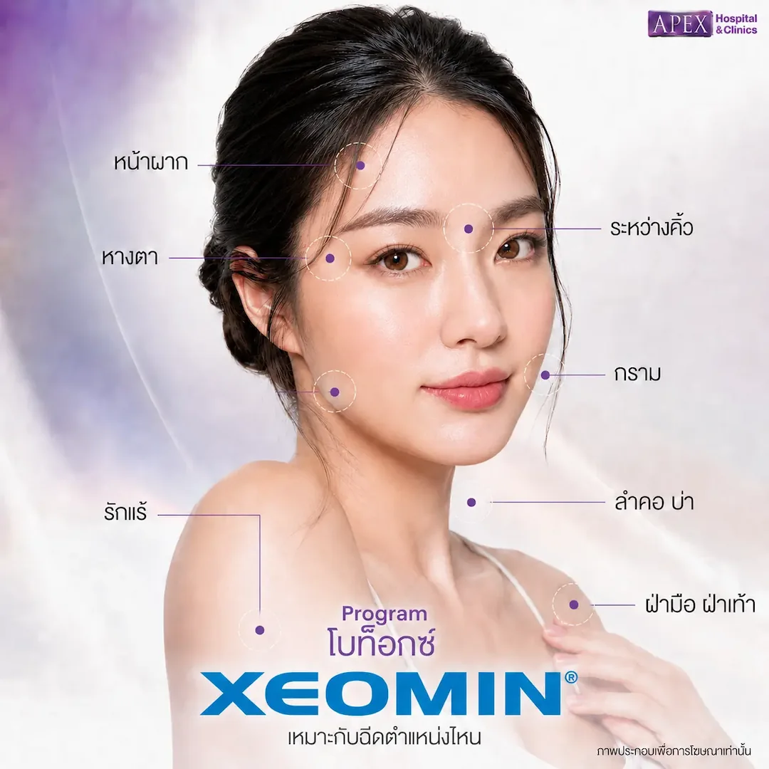 Xeomin Botox ช่วยเรื่องอะไร