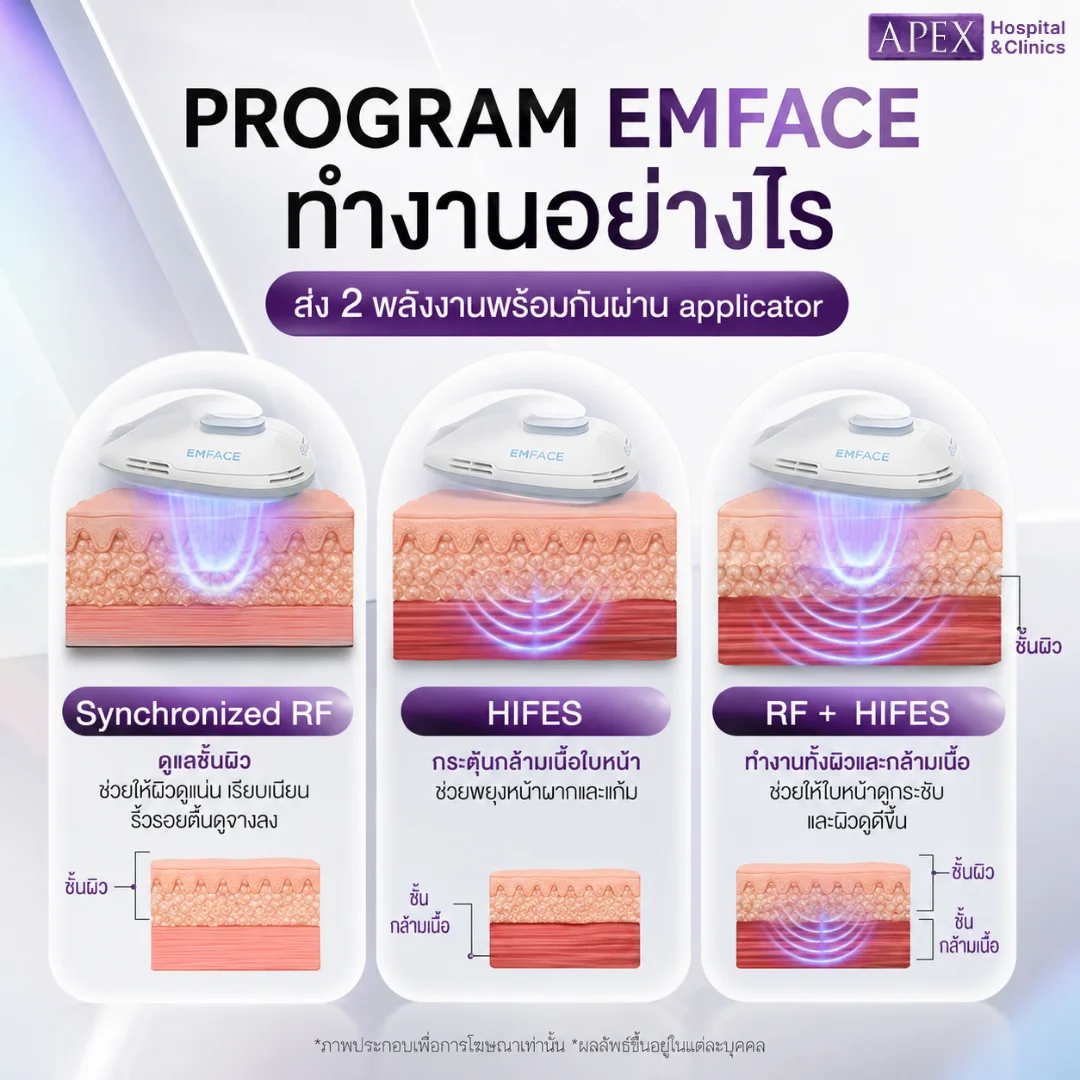 กลไกการทำงานของ Emface
